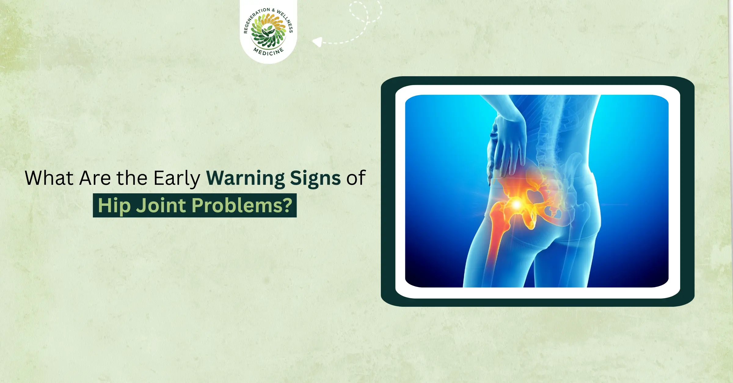 What Are the Early Warning Signs of Hip Joint Problems